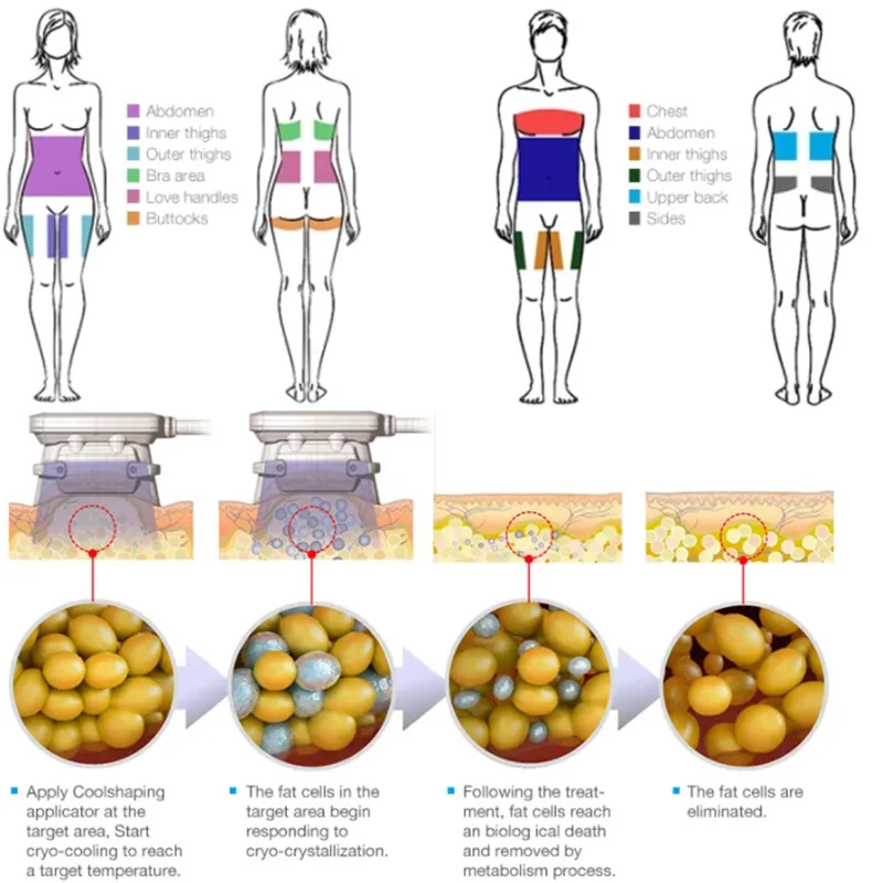 Professional 360 Cryo Sculpting Body Slimming Machine