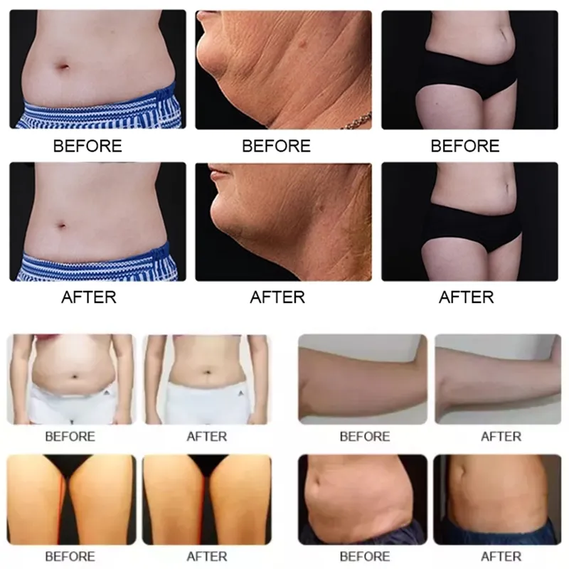 Professional 360 Cryo Sculpting Body Slimming Machine