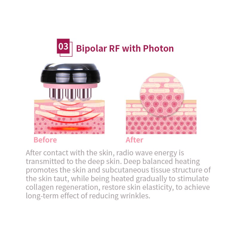 7-in-1 Cavitation, Vacuum, RF & Cryo Fat Freezing Slimming Machine