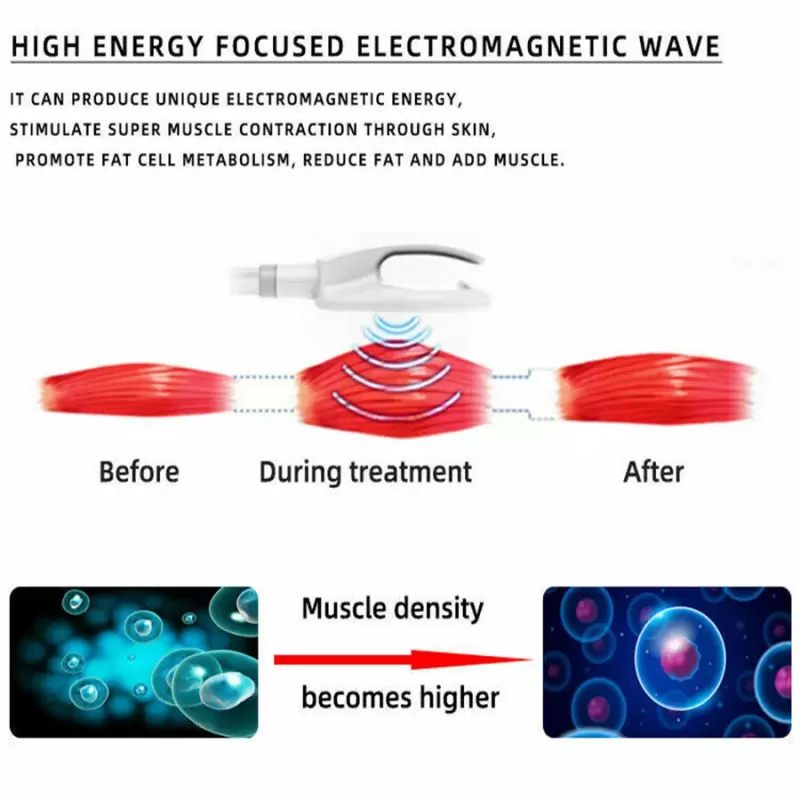 2 Handles EMS Sculpting RF Muscle Building Skin Tightening Machine