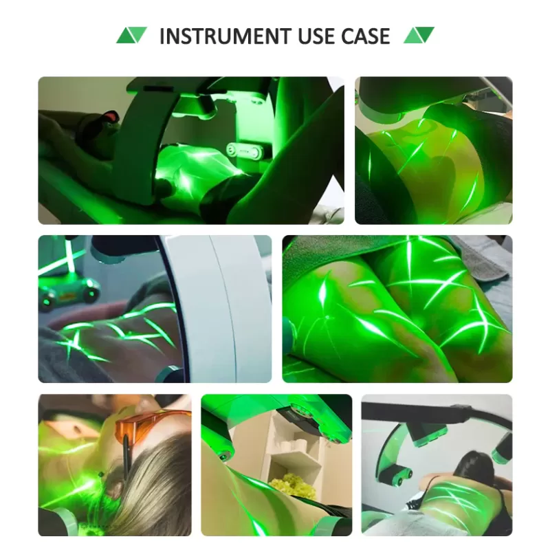 10D Shaping Laser 532nm 635nm Green Light Body Sculpting Machine