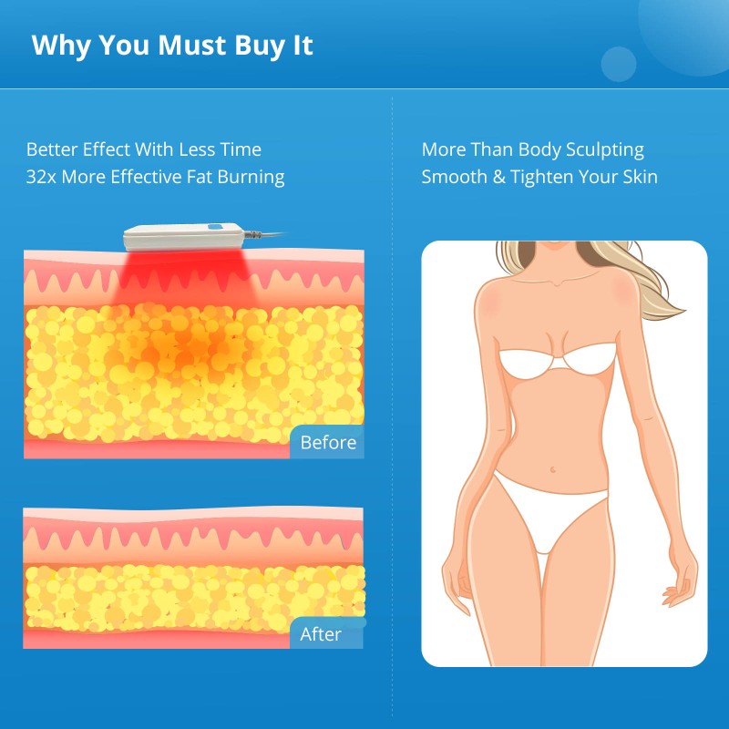 Joosbeauty 160MW Laser Lipo 14 Pads Body Slimming Machine