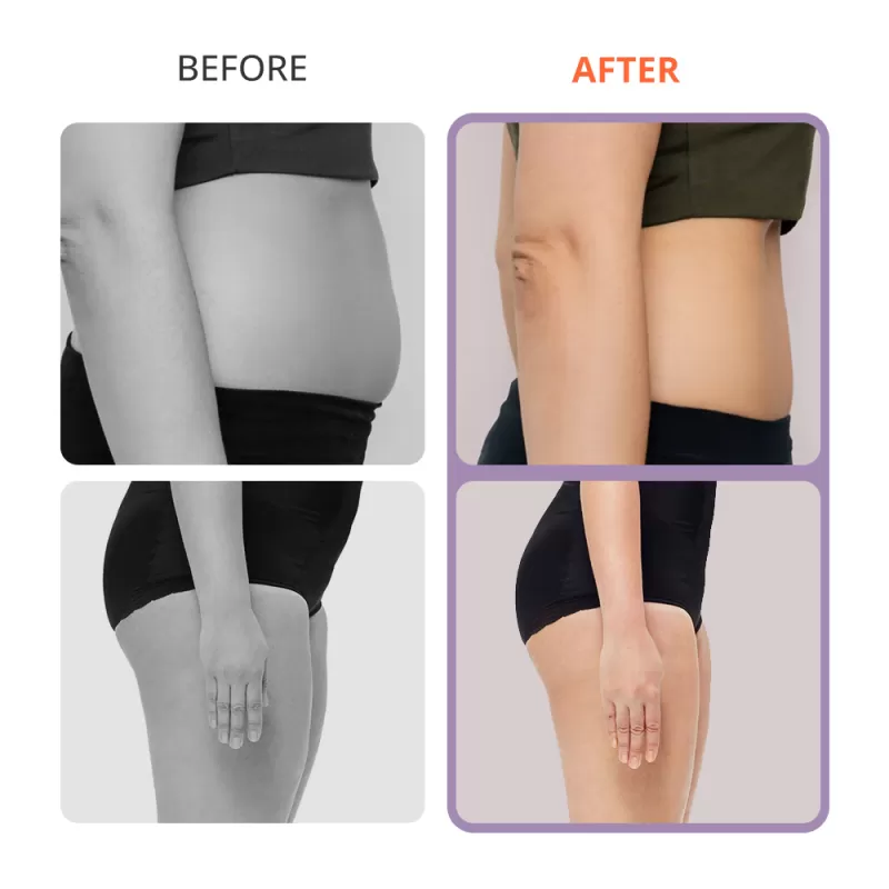 S Shape 30K Ultrasound Cavitation RF Body Shaping & Facial Lifting Machine