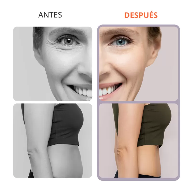 Máquina S Shape de Ultrasonido 30K con Cavitación RF para Moldeado Corporal y Lifting Facial de Uso Doméstico