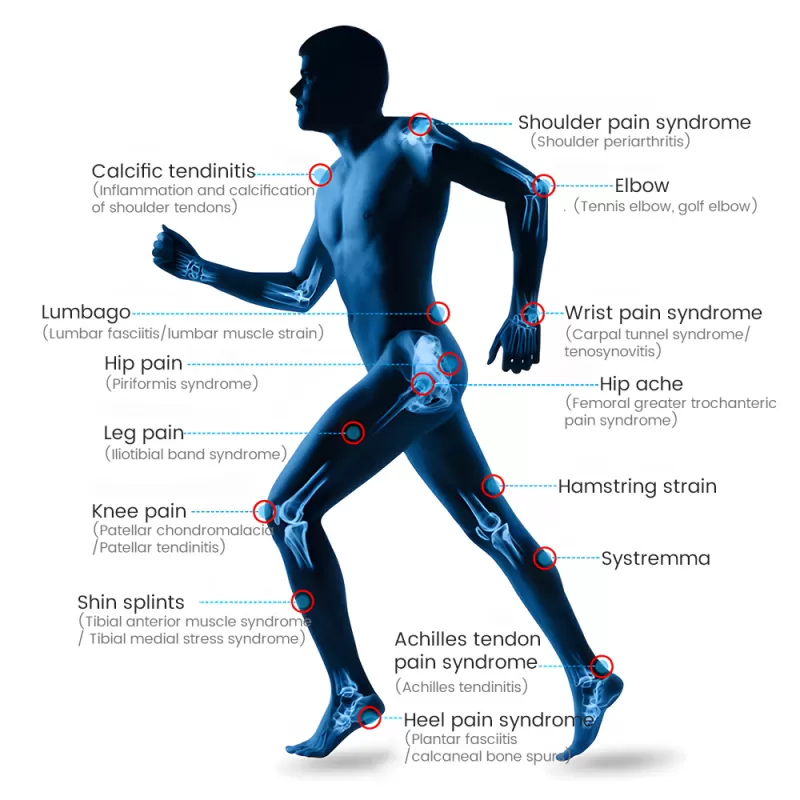 Focus Shockwave Therapy Machine for Deep Tissue Pain Relief & Rehabilitation