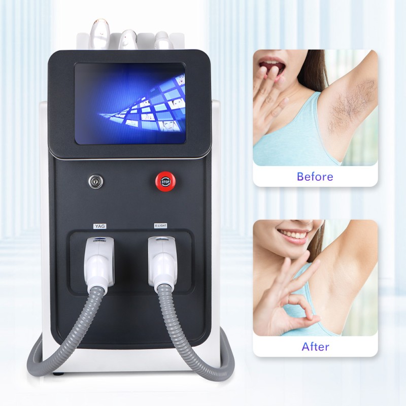 3 in 1 Multifunction Q-switched IPL+RF+Nd Yag Hair Tattoo Removal Machine