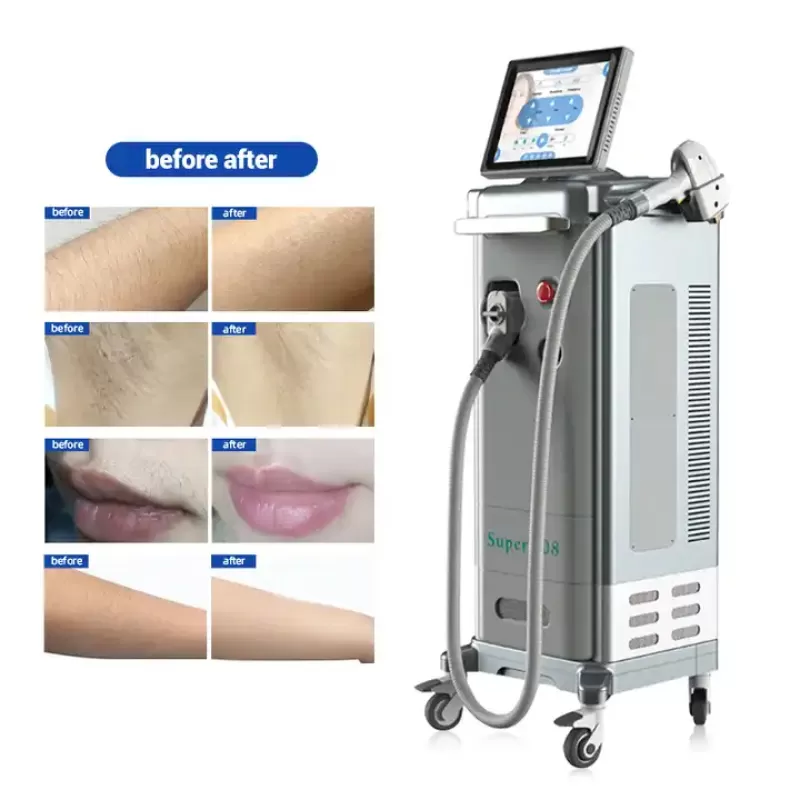 Professional 755 808 1064 Permanent Diode Laser Hair Removal Machine