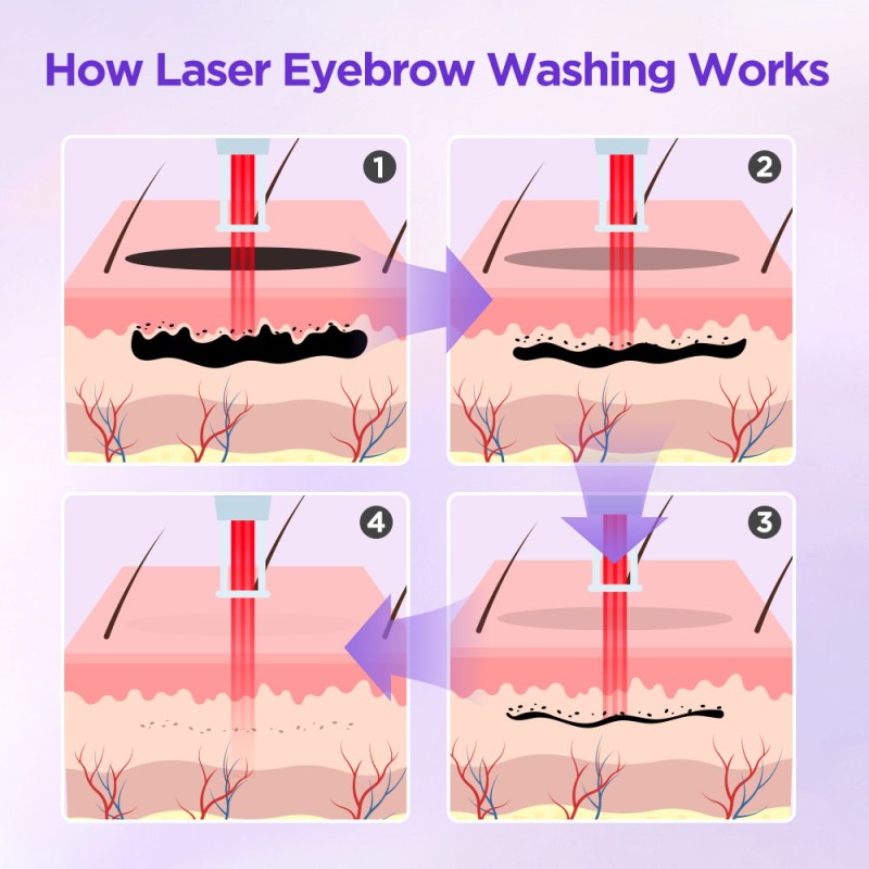 2-In-1 Picosecond 808 Diode Laser Hair Removal Machine