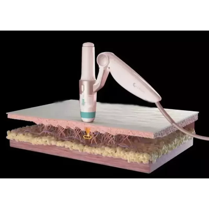 New 7D Hifuu Facial Anti-Aging Wrinkle Removal Machine