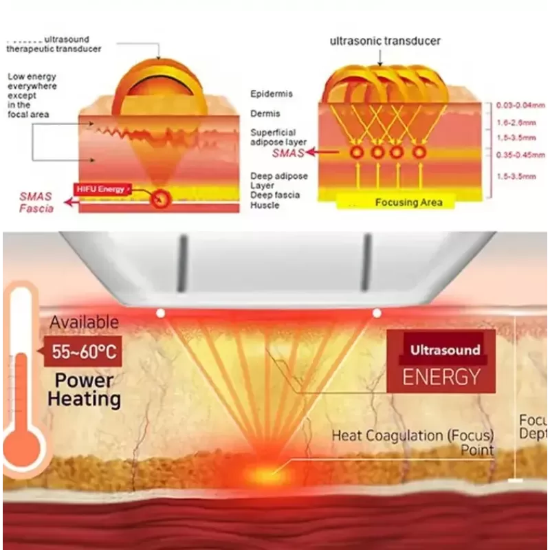 New 7D Hifuu Facial Anti-Aging Wrinkle Removal Machine