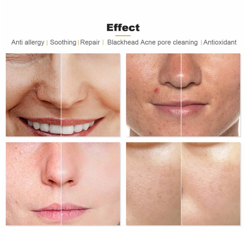 6 In 1 Hydrafacial Dermabrasion Face Cleansing Skin Rejuvenation Machine