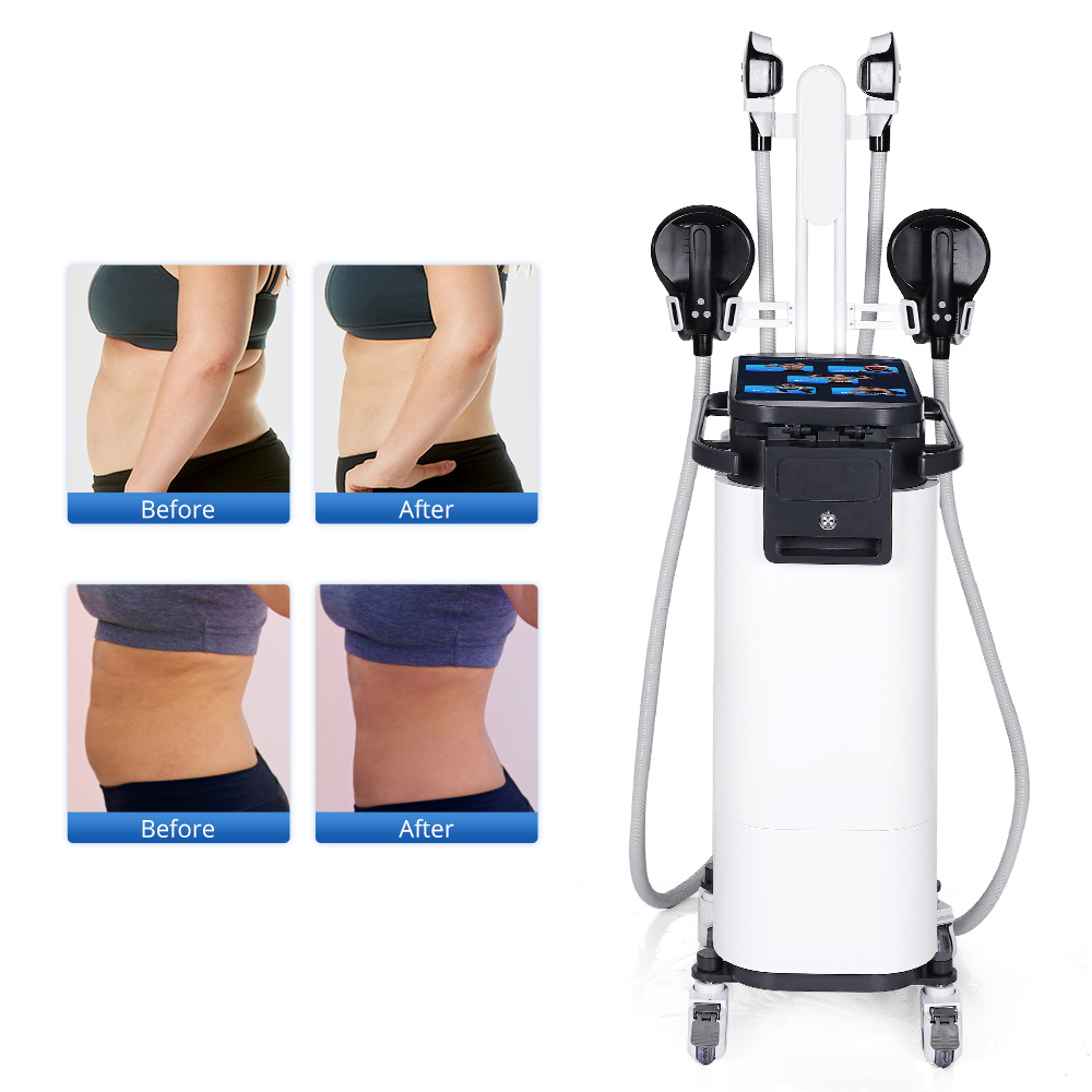 EMS 4 Handles With RF Body Sculpting Machine